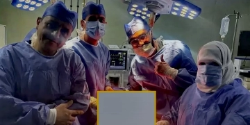 مستشفى كفرالشيخ العام : إجراء جراحة دقيقة ومعقدة لإستئصال ورم ضخم يزن حوالي 10 كيلوجرامات خارج من الرحم 1 - جريدة المساء