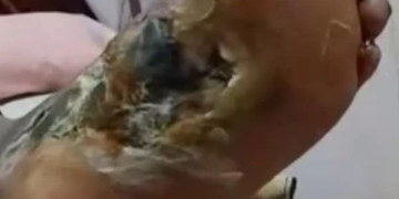 همسة لوزير الصحة 1 - جريدة المساء