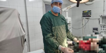 لأول مرة بمستشفيات المنوفية..منظم قلب ثلاثي بالصاعق (CRT-D) بـ «أشمون العام» 1 - جريدة المساء